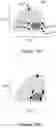 Fig. 18 - IMPLANTABLE MARKERS TO AID SURGICAL OPERATIONS
