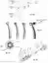 Fig. 10 - Interproximal polishing bur