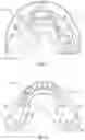 Fig. 07 - Orofacial apparatuses and methods