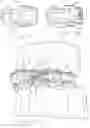Fig. 04 - Orthodontic Post and Pin Assembly