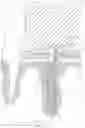 Fig. 02 - Zirconium Post