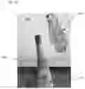 Fig. 03 - 3D scanner system with handheld scanner