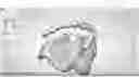 Fig. 01 - Common Placement Support for Artificial Teeth
