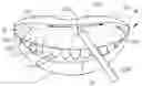 Fig. 01 - Method of establishing upper boundary for dental prosthetic