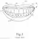 Fig. 02 - Method of establishing upper boundary for dental prosthetic