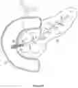 Fig. 05 - Implantable intraluminal device