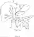 Fig. 06 - Implantable intraluminal device