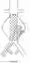 Fig. 07 - DEVICES AND METHODS FOR TREATMENT OF VASCULAR ANEURYSMS