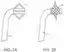 Fig. 09 - DEVICES AND METHODS FOR TREATMENT OF VASCULAR ANEURYSMS
