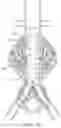 Fig. 16 - DEVICES AND METHODS FOR TREATMENT OF VASCULAR ANEURYSMS