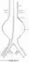 Fig. 23 - DEVICES AND METHODS FOR TREATMENT OF VASCULAR ANEURYSMS
