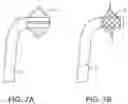 Fig. 09 - DEVICES AND METHODS FOR TREATMENT OF VASCULAR ANEURYSMS