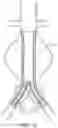 Fig. 15 - DEVICES AND METHODS FOR TREATMENT OF VASCULAR ANEURYSMS