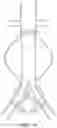 Fig. 17 - DEVICES AND METHODS FOR TREATMENT OF VASCULAR ANEURYSMS