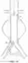 Fig. 18 - DEVICES AND METHODS FOR TREATMENT OF VASCULAR ANEURYSMS