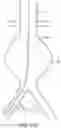 Fig. 23 - DEVICES AND METHODS FOR TREATMENT OF VASCULAR ANEURYSMS