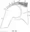 Fig. 04 - Implantable articles for attaching tendons and/or ligaments to bone and/or cartilage, assemblies thereof, and methods of use thereof