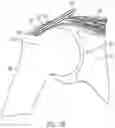 Fig. 05 - Implantable articles for attaching tendons and/or ligaments to bone and/or cartilage, assemblies thereof, and methods of use thereof