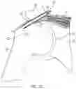 Fig. 06 - Implantable articles for attaching tendons and/or ligaments to bone and/or cartilage, assemblies thereof, and methods of use thereof