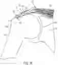Fig. 08 - Implantable articles for attaching tendons and/or ligaments to bone and/or cartilage, assemblies thereof, and methods of use thereof