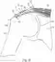 Fig. 09 - Implantable articles for attaching tendons and/or ligaments to bone and/or cartilage, assemblies thereof, and methods of use thereof