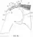 Fig. 10 - Implantable articles for attaching tendons and/or ligaments to bone and/or cartilage, assemblies thereof, and methods of use thereof