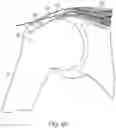 Fig. 11 - Implantable articles for attaching tendons and/or ligaments to bone and/or cartilage, assemblies thereof, and methods of use thereof
