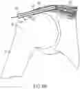 Fig. 12 - Implantable articles for attaching tendons and/or ligaments to bone and/or cartilage, assemblies thereof, and methods of use thereof