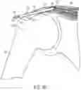 Fig. 14 - Implantable articles for attaching tendons and/or ligaments to bone and/or cartilage, assemblies thereof, and methods of use thereof