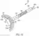 Fig. 21 - Implantable articles for attaching tendons and/or ligaments to bone and/or cartilage, assemblies thereof, and methods of use thereof