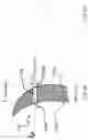 Fig. 04 - Ophthalmic device having opaque and decentered light-transmissive portions for alleviating symptoms relating to ocular diseases