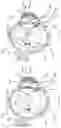 Fig. 05 - Ophthalmic device having opaque and decentered light-transmissive portions for alleviating symptoms relating to ocular diseases