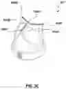Fig. 06 - Electrospun medical devices and methods of making electrospun medical devices