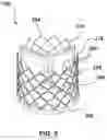 Fig. 12 - Electrospun medical devices and methods of making electrospun medical devices