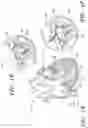 Fig. 04 - Prosthetic cardiovascular valves and methods for replacing native atrioventricular valves with same