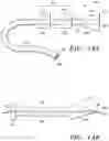 Fig. 20 - Prosthetic cardiovascular valves and methods for replacing native atrioventricular valves with same