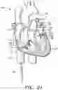 Fig. 30 - Prosthetic cardiovascular valves and methods for replacing native atrioventricular valves with same