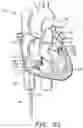 Fig. 32 - Prosthetic cardiovascular valves and methods for replacing native atrioventricular valves with same