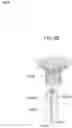 Fig. 30 - Prosthetic heart valve and systems and methods for delivering the same