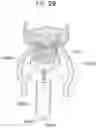 Fig. 31 - Prosthetic heart valve and systems and methods for delivering the same