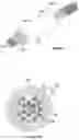Fig. 06 - Deployment restraint and delivery system for implantable cardiac device