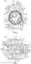 Fig. 03 - Prosthetic joint with cam locking mechanism