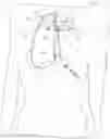 Fig. 01 - Systems and methods for treating eye diseases