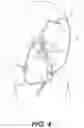 Fig. 06 - Systems and methods for treating eye diseases