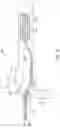 Fig. 06 - Devices and methods for ocular surgery