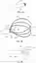 Fig. 09 - Devices and methods for ocular surgery