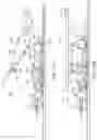 Fig. 22 - Devices and methods for ocular surgery