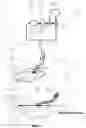 Fig. 02 - APPARATUS FOR ASPIRATING, IRRIGATING AND CLEANSING WOUNDS