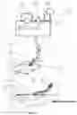 Fig. 12 - APPARATUS FOR ASPIRATING, IRRIGATING AND CLEANSING WOUNDS
