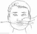Fig. 01 - STERILE MOUTH-INSERTABLE DEVICE TO STOP A NOSEBLEED